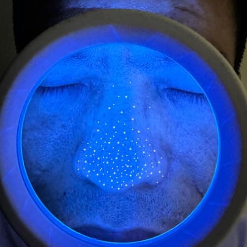 Cordless Wood's Lamp for Ringworm Detection - Skin Testing for Estheticians and Veterinarians - 5x Magnifying Wood Lamp with 16 LED Battery Powered