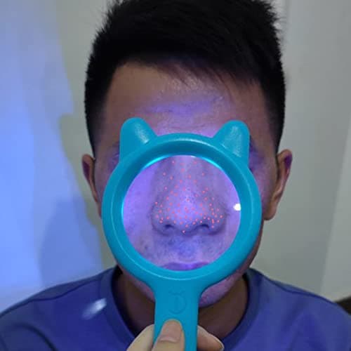 1. Professional Skin Analyzer Light
2. Wood's Lamp Ringworm Detection Light
3. Wood Lamp with Magnifier
4. Wood's Lamp for Skin Testing